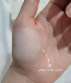 تینت پوست شیگلم
