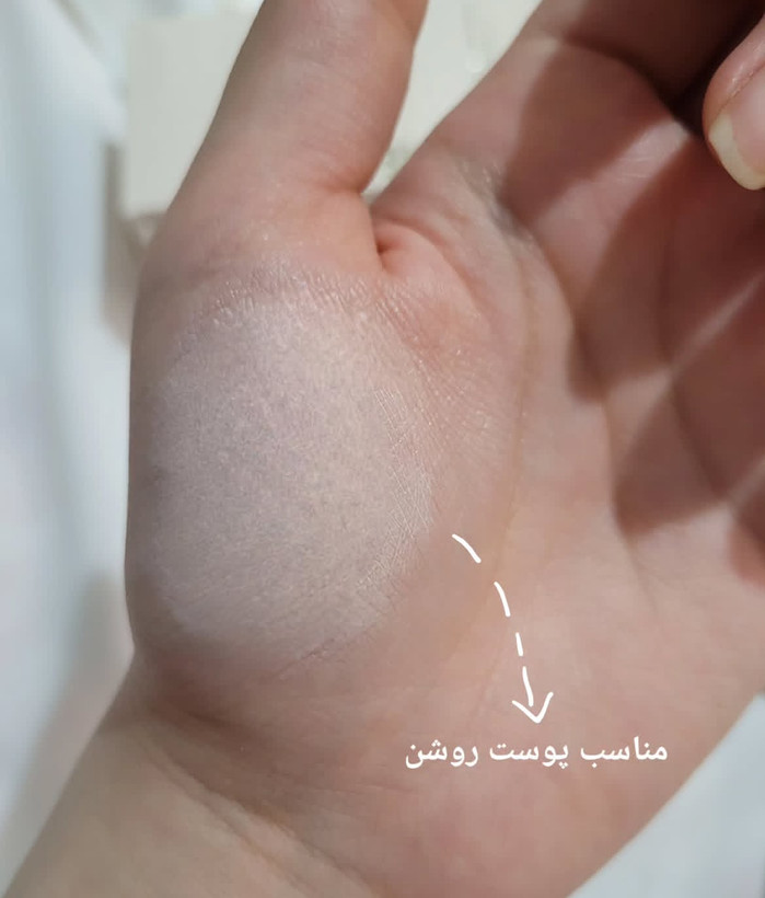 تینت پوست شیگلم
